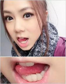 歪牙明星,揭秘明星们的独特魅力与自信风采